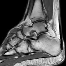 Ankle and foot imaging