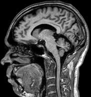 Brain imaging