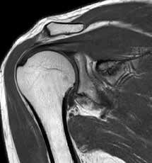 Shoulder imaging
